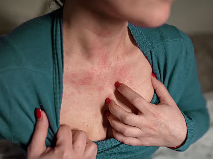 dị ứng nước sinh hoạt